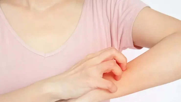 Geceleri Artan Kaşıntılarınız Varsa Bu Hastalığa Dikkat!